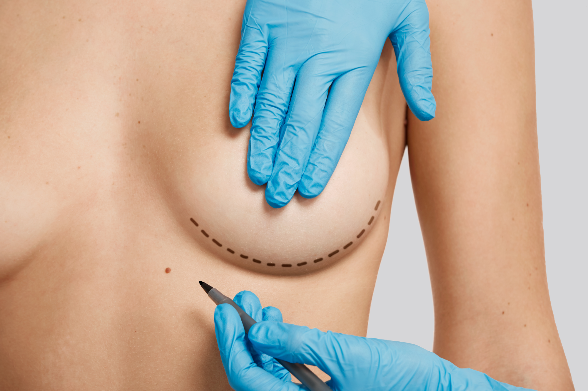 endoscopy3.png